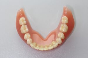 入れ歯の画像（下）