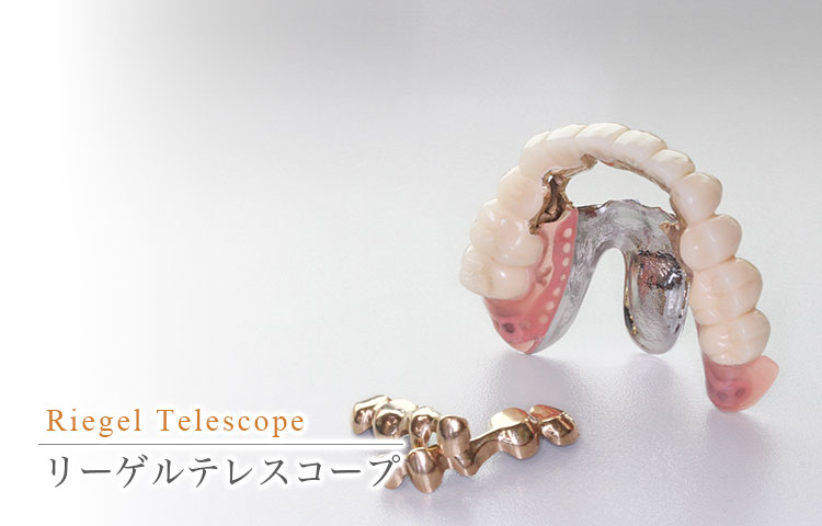 宮城／岩沼／仙台で「ドイツ式リーゲルテレスコープ部分入れ歯」｜佐藤